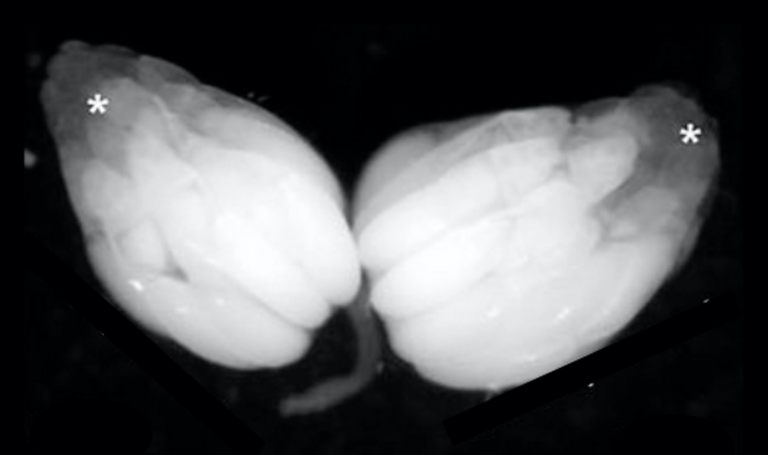 Drosophila melanogaster ovaries under a stereomicroscope